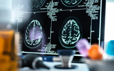3ème Journée Régionale d’Epilepsie AURA